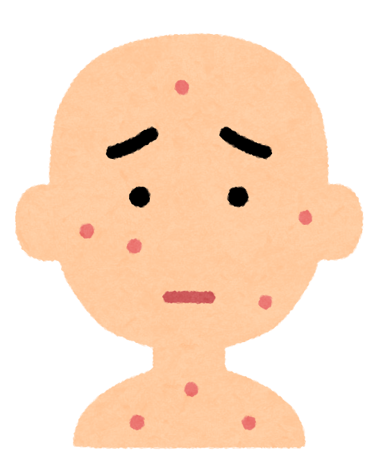 エムポックス