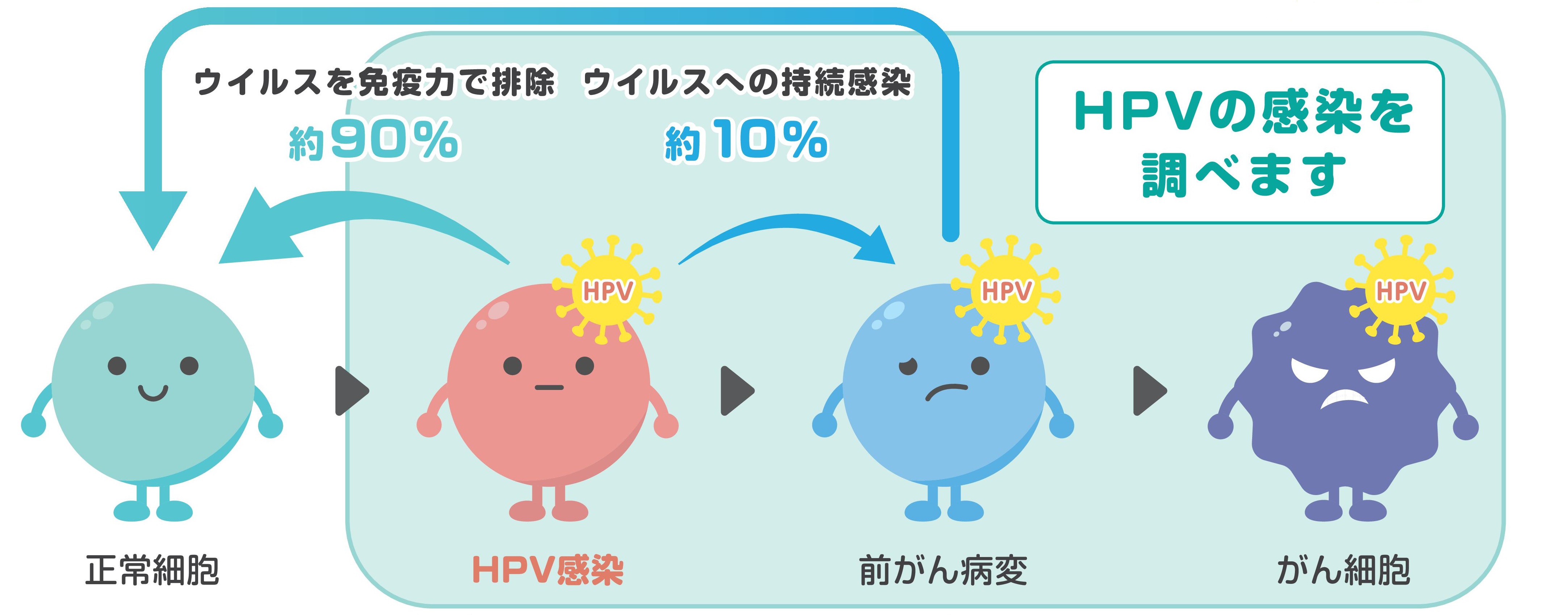 進行イメージ